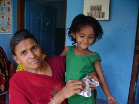 Bimba ustione -Calcutta-